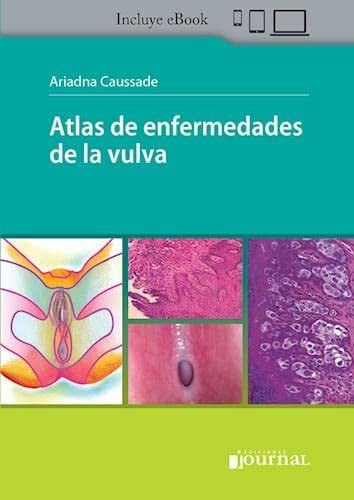 ATLAS DE ENFERMEDADES DE LA VULVA, de CAUSSADE | portada del libro
