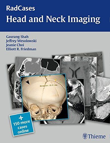HEAD AND NECK IMAGING RADCASES SERIES 150 MORE CASES ONLINE, de SHAH | portada del libro