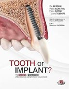 TOOTH OR IMPLANT THE RECOVERY OR REPLACEMENT OF THE SEVERE, de Varios autores | portada del libro