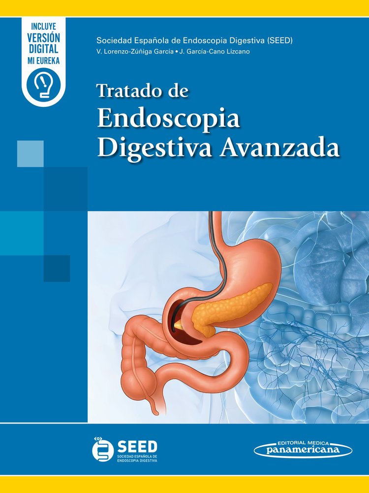 TRATADO DE ENDOSCOPIA DIGESTIVA AVANZADA (+E-BOOK), de LORENZO-ZUÑIGA, VICENTE | portada del libro
