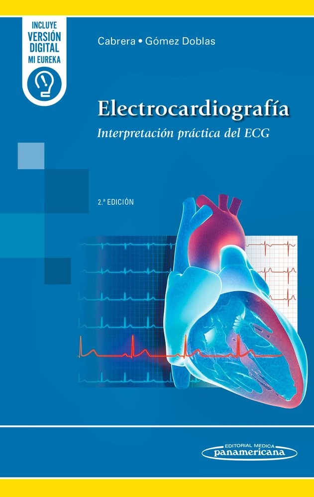 ELECTROCARDIOGRAMA:INTERPRETACION PRACTICA DEL EGG, de CABRERA BUENO, FERNANDO | portada del libro