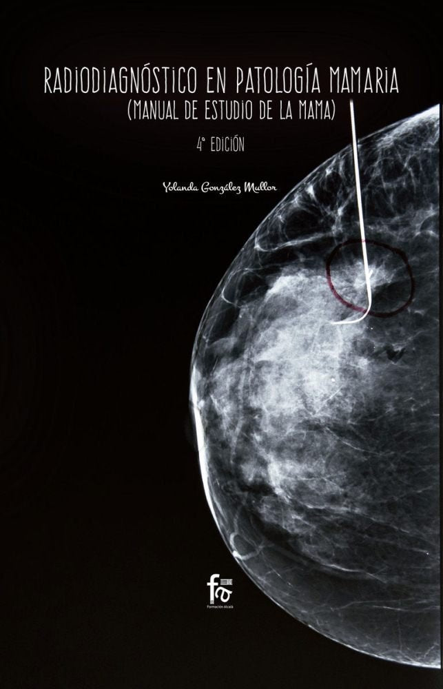 RADIODIAGNOSTICO EN PATOLOGIA MAMARIA-4 ED, de GONZALEZ MULLOR, YOLANDA | portada del libro