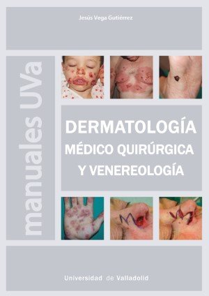 DERMATOLOGIA MEDICO QUIRURGICA Y VENEREOLOGIA, de VEGA GUTIERREZ | portada del libro