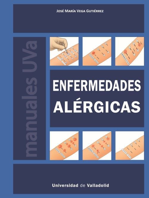 ENFERMEDADES ALERGICAS, de VEGA GUTIERREZ, JOSE MARIA | portada del libro