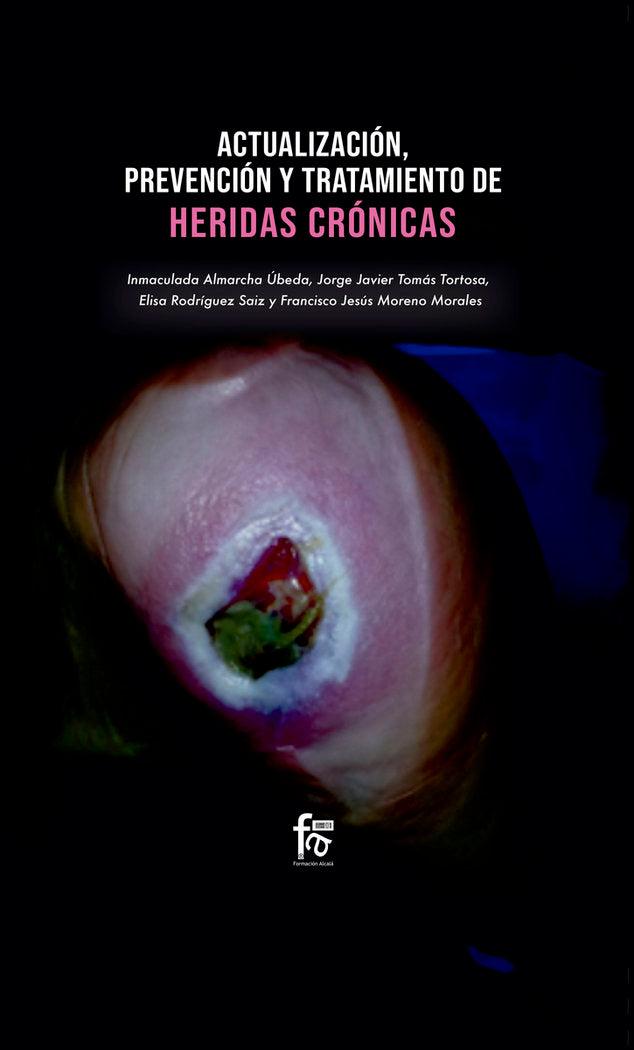 ACTUALIZACIONES, PREVENCIÓN Y TRATAMIENTO DE HERIDAS CRÓNICAS, de ALMARCHA ÚBEDA, INMACULADA | portada del libro