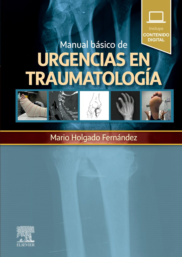 MANUAL BASICO DE URGENCIAS EN TRAUMATOLOGIA, de HOLGADO, MARIO | portada del libro