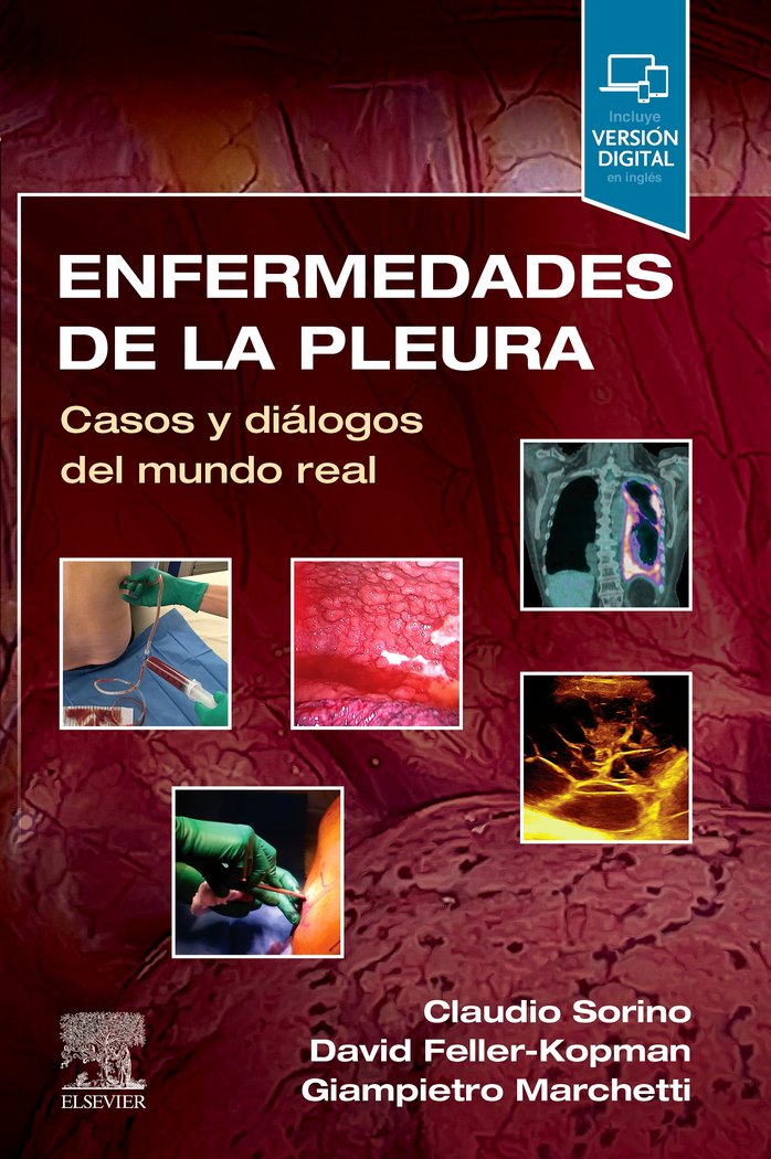 ENFERMEDADES DE LA PLEURA, de SORINO, CLAUDIO | portada del libro