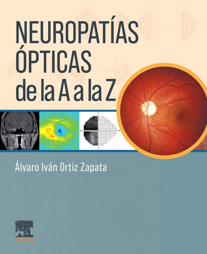 NEUROFTALMOLOGIA DE LA A A LA Z, de ORTIZ ZAPATA,A | portada del libro