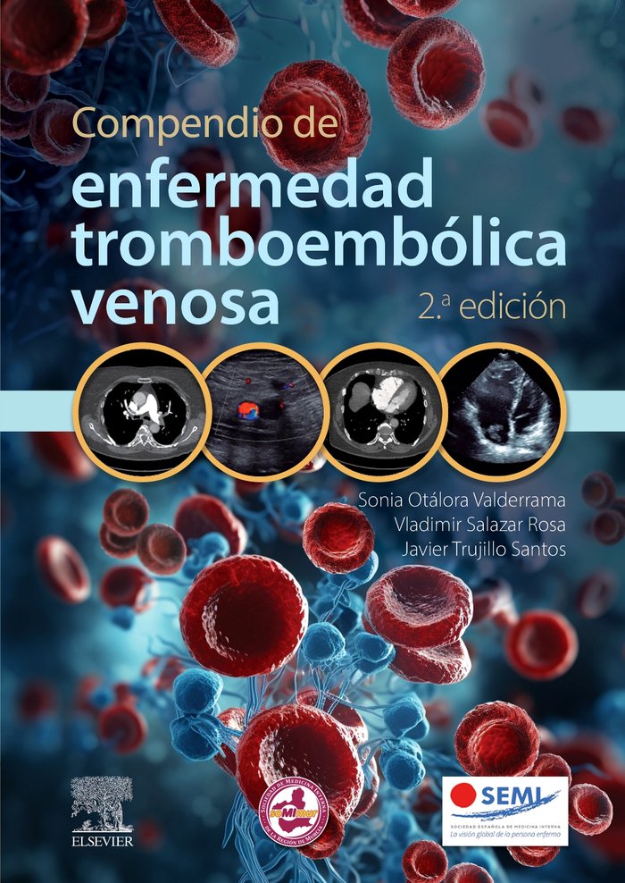 COMPENDIO DE ENFERMEDAD TROMBOEMBOLICA VENOSA 2ª ED, de OTALORA | portada del libro