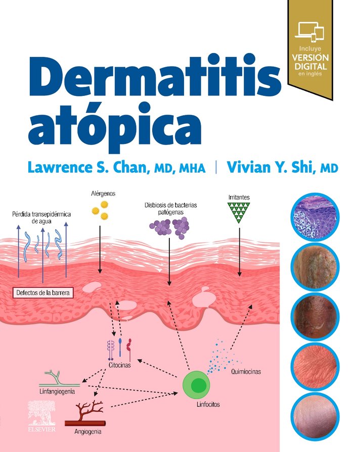 DERMATITIS ATOPICA, de CHAN | portada del libro
