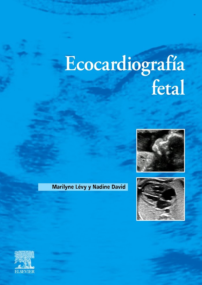 ECOCARDIOGRAFIA FETAL, de LEVY | portada del libro