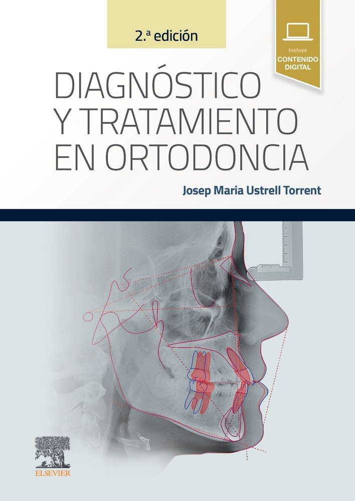025 DIAGNOSTICO Y TRATAMIENTO EN ORTODONCIA 2ª EDICION, de USTRELL | portada del libro