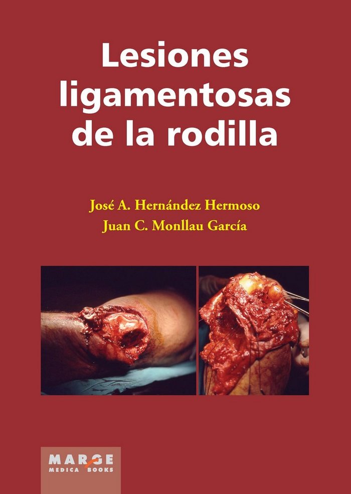 Lesiones ligamentosas de rodilla, de Monllau García, Juan | portada del libro