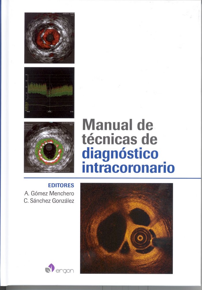 Manual de Técnicas de diagnóstico intracoronario, de Antonio Gómez Menchero#Carlos Sánchez González | portada del libro