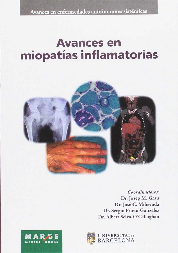 Avances en miopatías inflamatorias | portada del libro