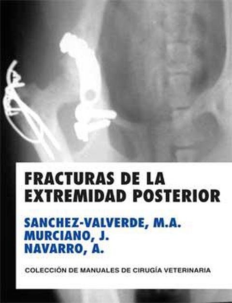 FRACTURAS DE LA EXTREMIDAD POSTERIOR, de SANCHEZ-VALVERDE GARCIA | portada del libro