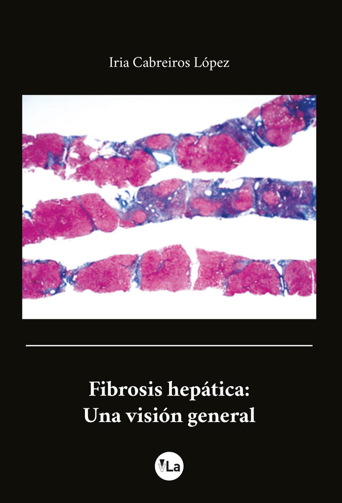 Fibrosis Hepática: Una visión general, de Cebreiros López, Iria | portada del libro