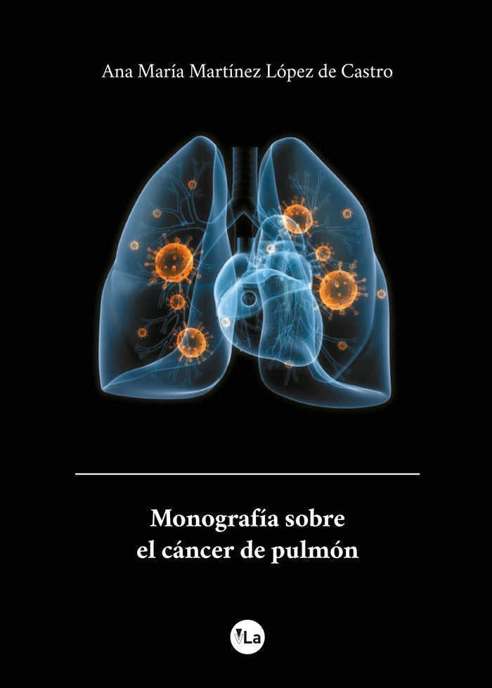 Monografía sobre el cáncer de pulmón, de Martínez López de Castro, Ana María | portada del libro