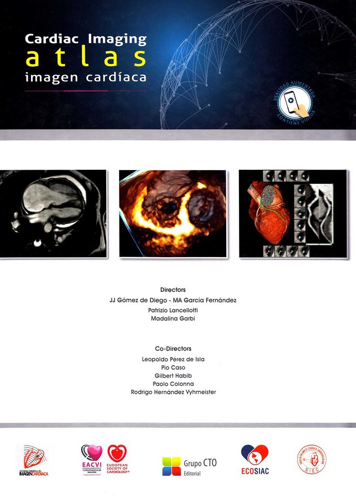 Atlas de Imagen Cardíaca-Cardiac Imaging Atlas, de AA.VV. | portada del libro