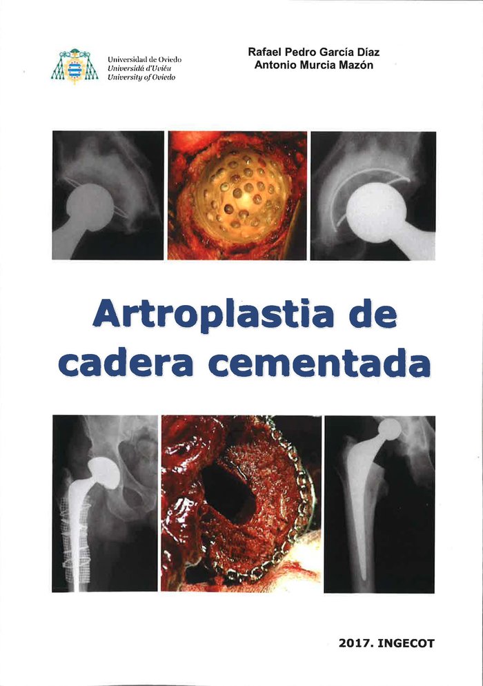 Artroplastia de cadera cementada, de GARCIA DIAZ | portada del libro