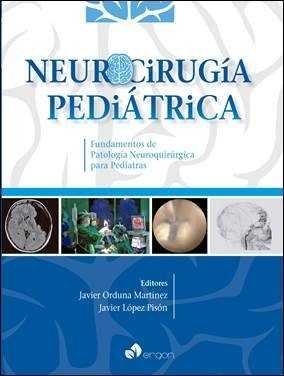 Neurocirugía pediátrica. Fundamentos de Patología Neuroquirúrgica para Pediatras, de Javier Orduna Martínez | portada del lib