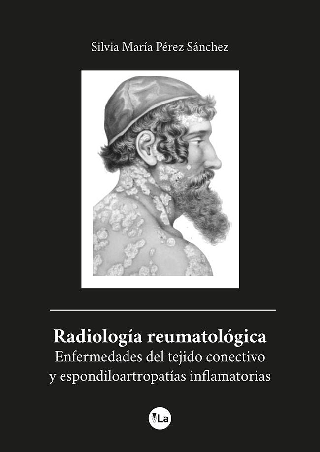 Radiología reumatológica, de Pérez Sánchez, Silvia María | portada del libro