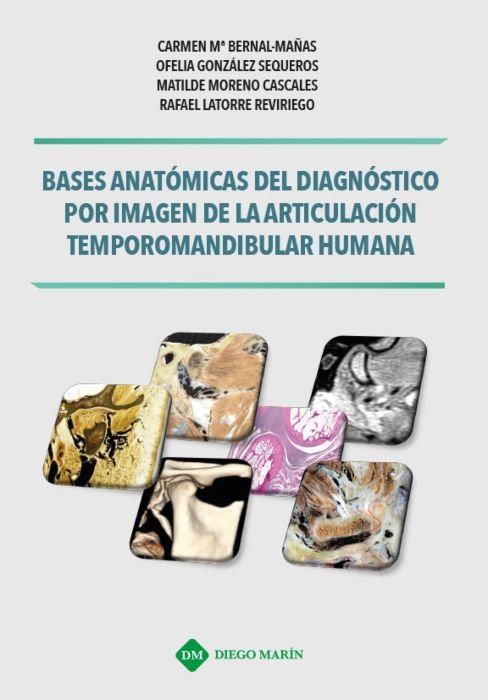 BASES ANATOMICAS DEL DIAGNOSTICO POR IMAGEN DE LA ARTICULACION TEMPOROMANDIBULAR HUMANA, de BERNAL MAÑAS | portada del libro