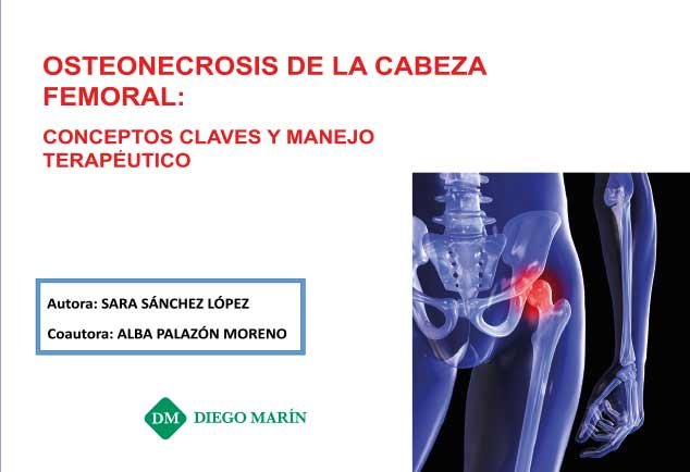 OSTEONECROSIS DE LA CABEZA FEMORAL:CONCEPTOS CLAVES Y MANEJO TERAPEUTICO, de SANCHEZ LOPEZ | portada del libro