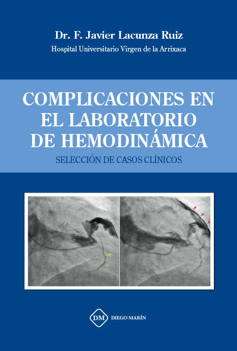 COMPLICACIONES EN EL LABORATORIO DE HEMODINAMICA, de LACUNZA RUIZ, FRANCISCO JAVIER | portada del libro