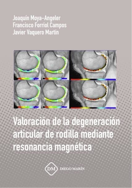 VALORACION DE LA DEGENERACION ARTICULAR DE RODILLA MEDIANTE RESONANCIA MAGNETICA, de MOYA-ANGELER PEREZ-MATEOS | portada del 