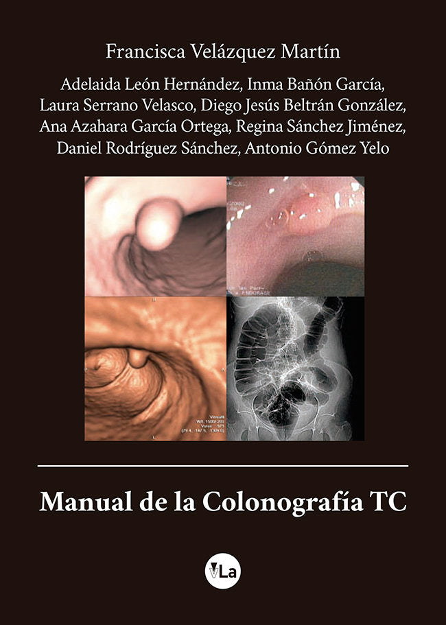 Manual de la Colonografía TC, de Velázquez Martín, Francisca | portada del libro