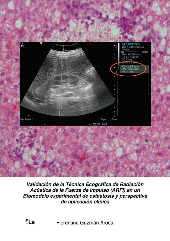 Validación de la técnica ecográfica de radiación acústica de la fuerza de impulso (ARFI) en un biomo, de Guzmán Aroca, Floren