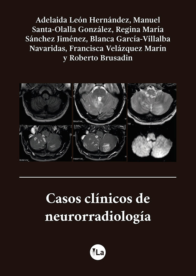 Casos clínicos de neurorradiología, de León Hernández, Adelaida | portada del libro