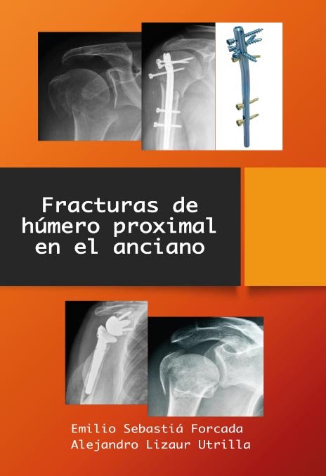 FRACTURAS DE HUMERO PROXIMAL EN EL ANCIANO, de SEBASTIA FORCADA, EMILIO | portada del libro