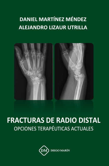 FRACTURAS DE RADIO DISTAL OPCIONES TERAPEUTICAS ACTUALES, de MARTINEZ MENDEZ | portada del libro