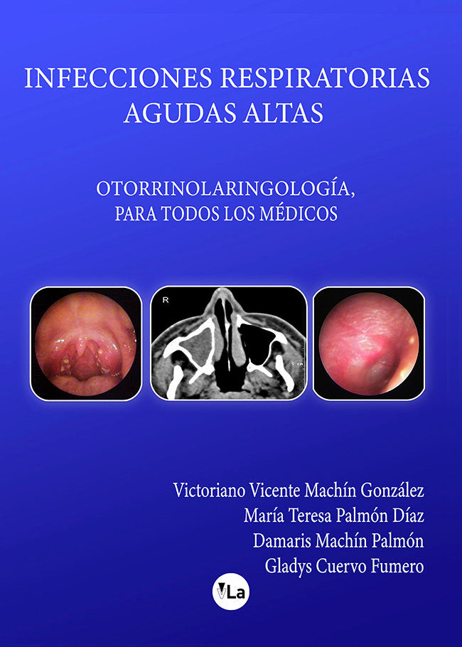 Infecciones respiratorias agudas altas, de Machín González, Victoriano Vicente | portada del libro
