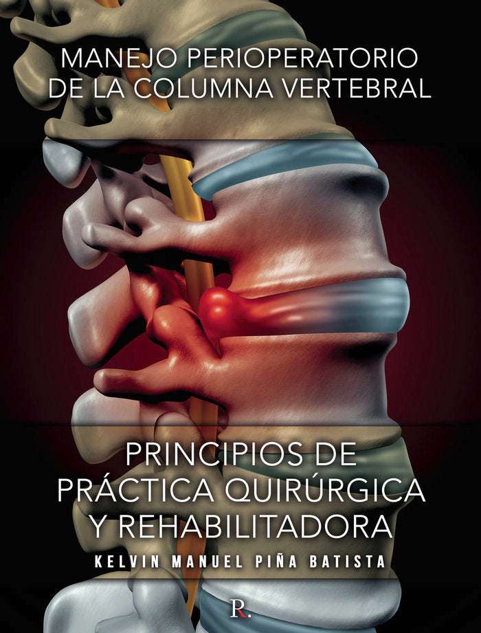 Manejo perioperatorio de la columna vertebral, de Piña Batista, Kelvin Manuel | portada del libro