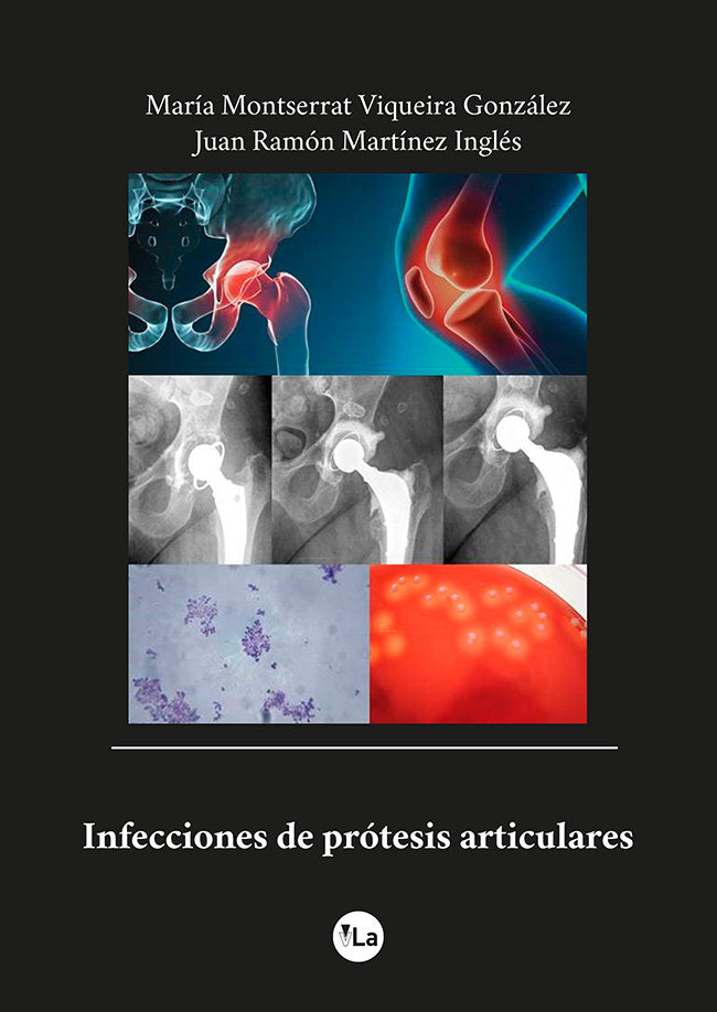 INFECCIONES DE PROTESIS ARTICULARES, de VIQUEIRA GONZALEZ, MARIA MONTSERRAT | portada del libro