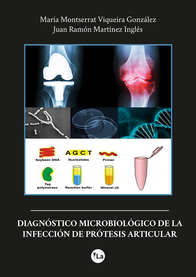DIAGNOSTICO MICROBIOLOGICO INFECCION PROTESIS ARTICULAR, de VIQUEIRA GONZALEZ, MARIA MONTSERRAT | portada del libro
