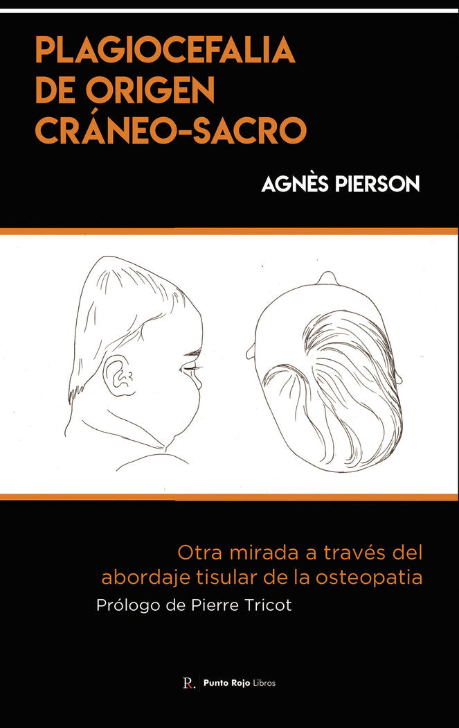 Plagiocefalia de origen cráneo-sacro, de Hernández Callejo, Miguel | portada del libro