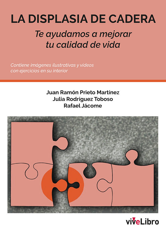 LA DISPLASIA DE CADERA, de PRIETO MARTINEZ, JUAN RAMON | portada del libro