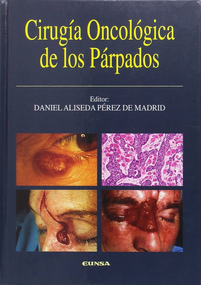 Cirugía oncológica de los párpados, de ALISEDA | portada del libro