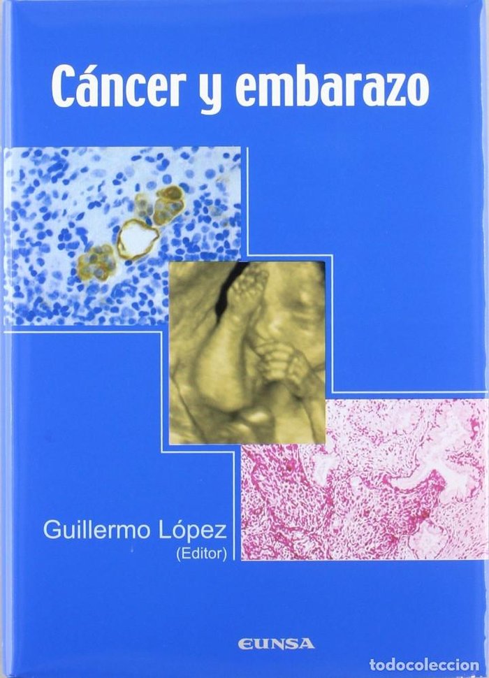 Cáncer y embarazo, de LOPEZ,GUILLERMO | portada del libro