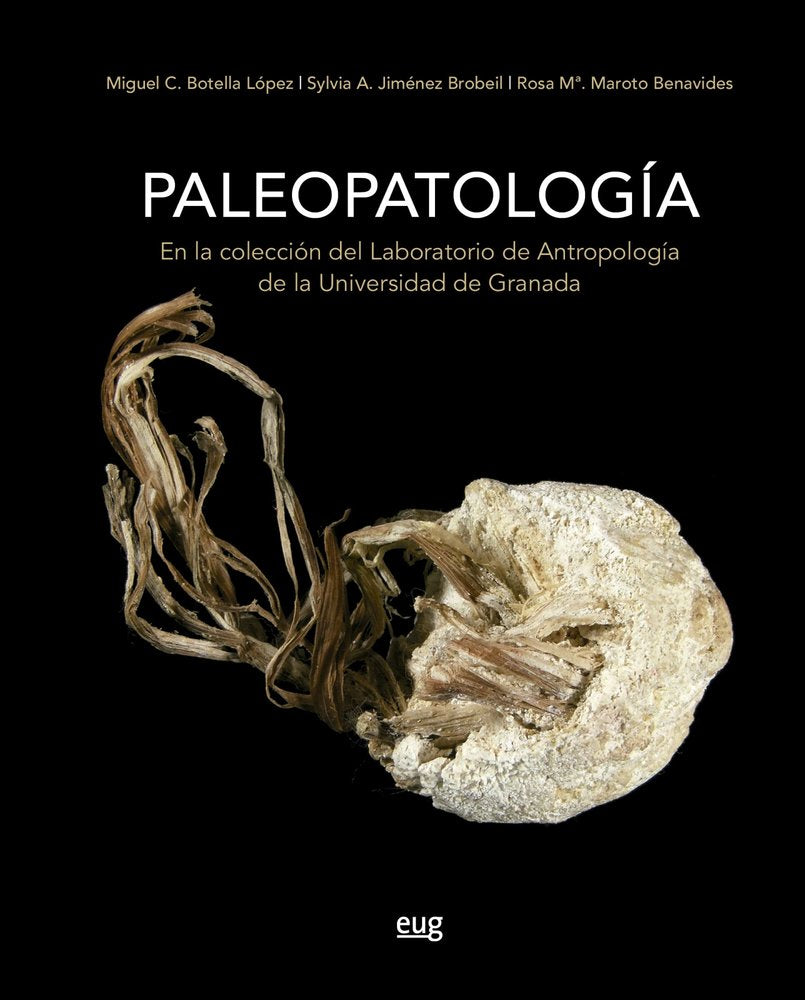 PALEOPATOLOGIA EN LA COLECCION DEL LABORATORIO DE ANTROPOLOGIA DE LA UNIVERSIDAD, de BOTELLA LOPEZ, MIGUEL C. | portada del l