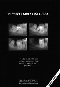 El tercer molar incluido, de Varios autores | portada del libro