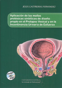 Aplicación de las mallas protésicas sintéticas de diseño propio en el Prolapso Vesical y en la incon, de Castiñeiras Fernánde