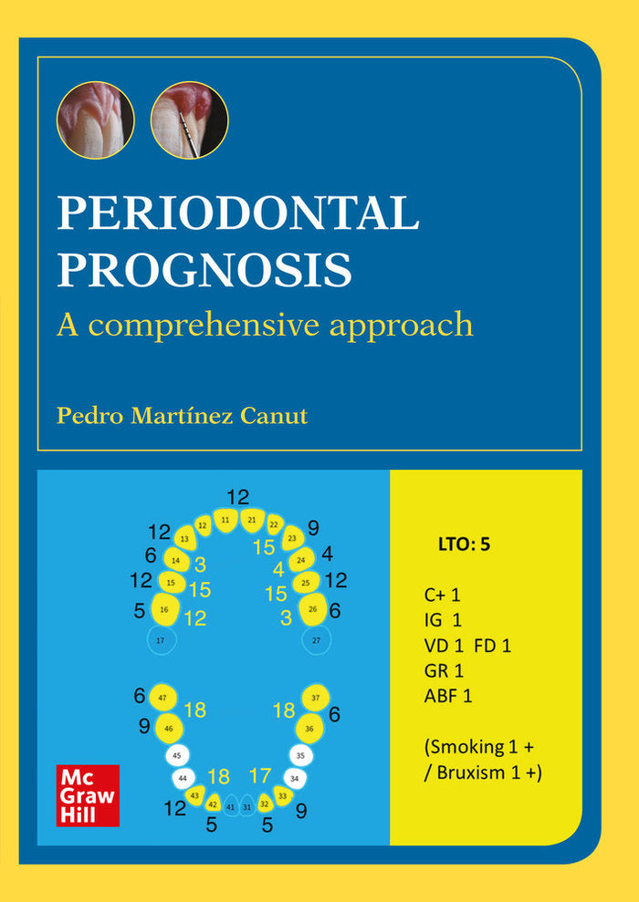 PERIODONTAL PROGNOSIS, de ALVARO GARCIA | portada del libro