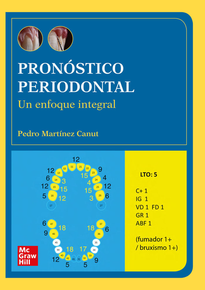Pronostico periodontal (POD), de MARTINEZ CANUT | portada del libro
