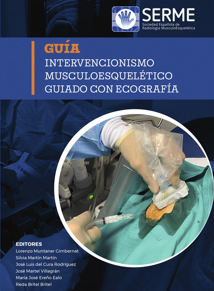 Intervencionismo musculoesquelético guiado con ecografía, de SERME, Sociedad Española de Radiología MusculoEsquelética | port