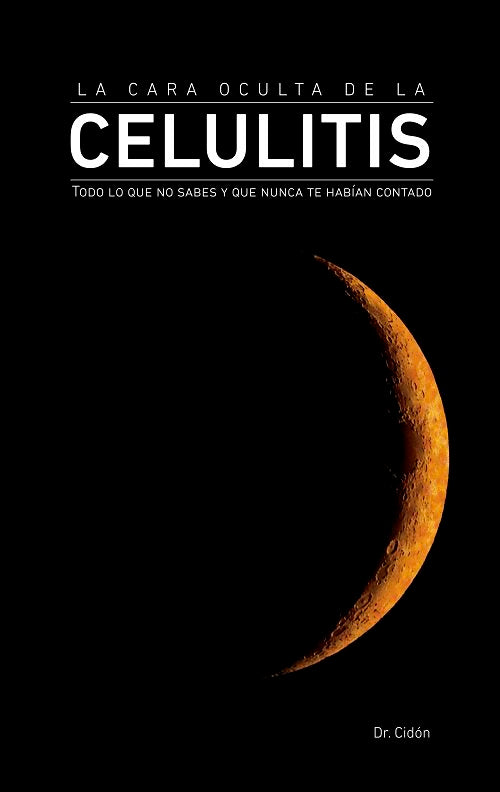 LA CARA OCULTA DE LA CELULITIS, de CIDON MADRIGAL, JOSE LUIS | portada del libro